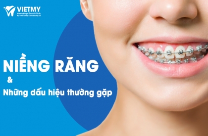 7 Dấu Hiệu Khi Niềng Răng Thường Gặp Và Cách Giảm Đau Hiệu Quả
